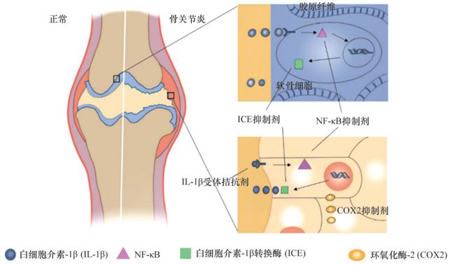 神经痛最新研究及治疗进展