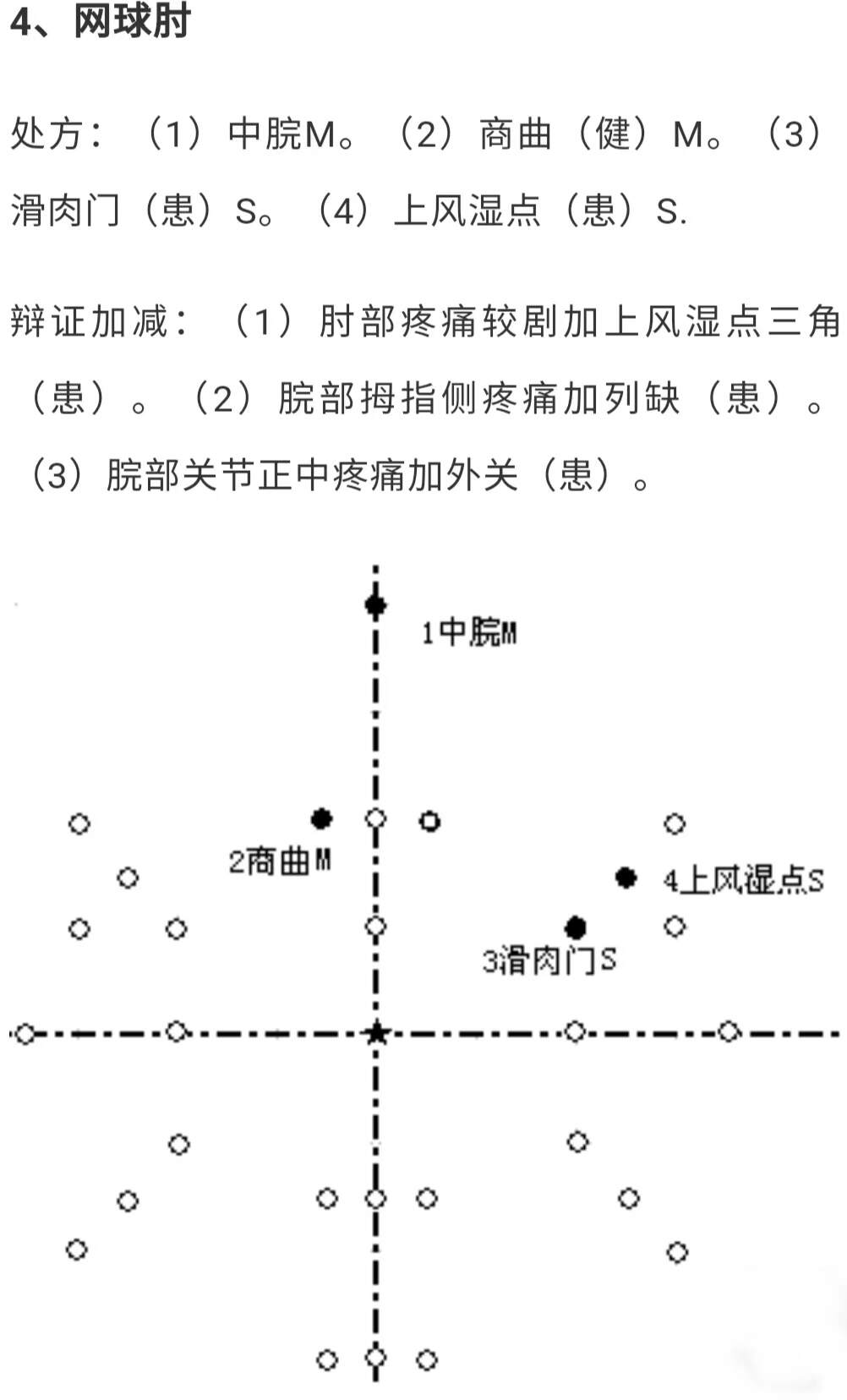 最新腹针笔记，探索中医针灸的新境界