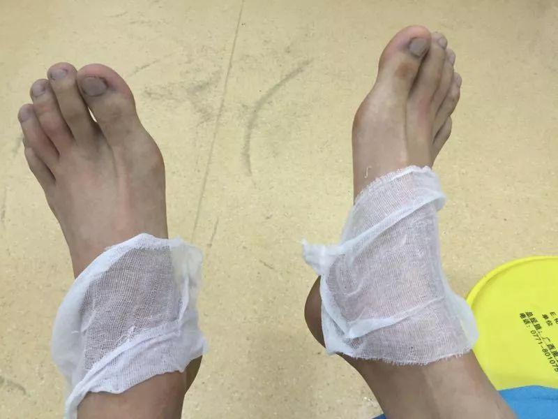 最新发热呼吸，探索人体奥秘与疾病预警的窗口